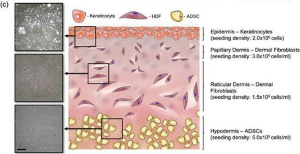 A schematic of a skin implant, clearly showing the three layers of human skin. 