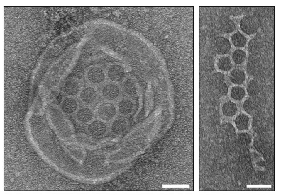 Electron microscope image of Runella bacteria gasdermin pores.