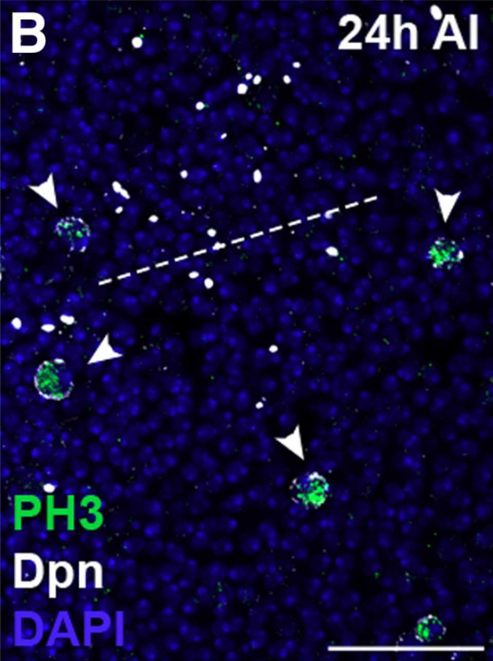 Neural stem cells in injured brains exhibit the green PH3 marker of mitosis.