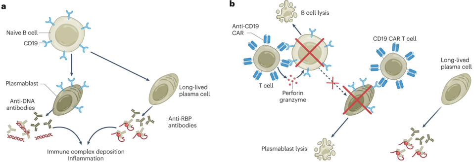 CAR T cells fight lupus by targeting CD19 antigen on B cells