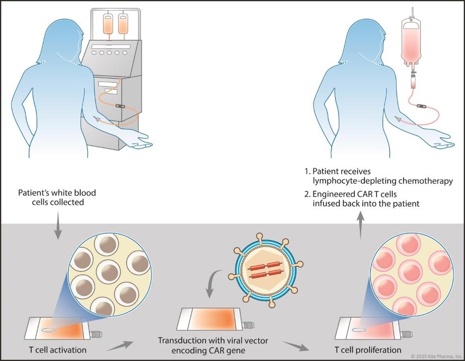 CAR T cell process