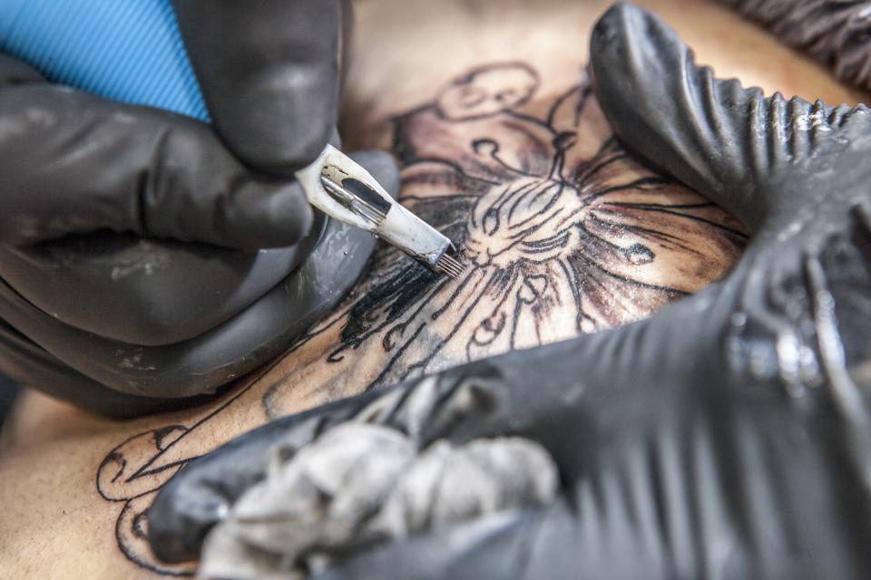 suspected cancer turns out to be tattoo ink suspected cancer turns out to be tattoo ink
