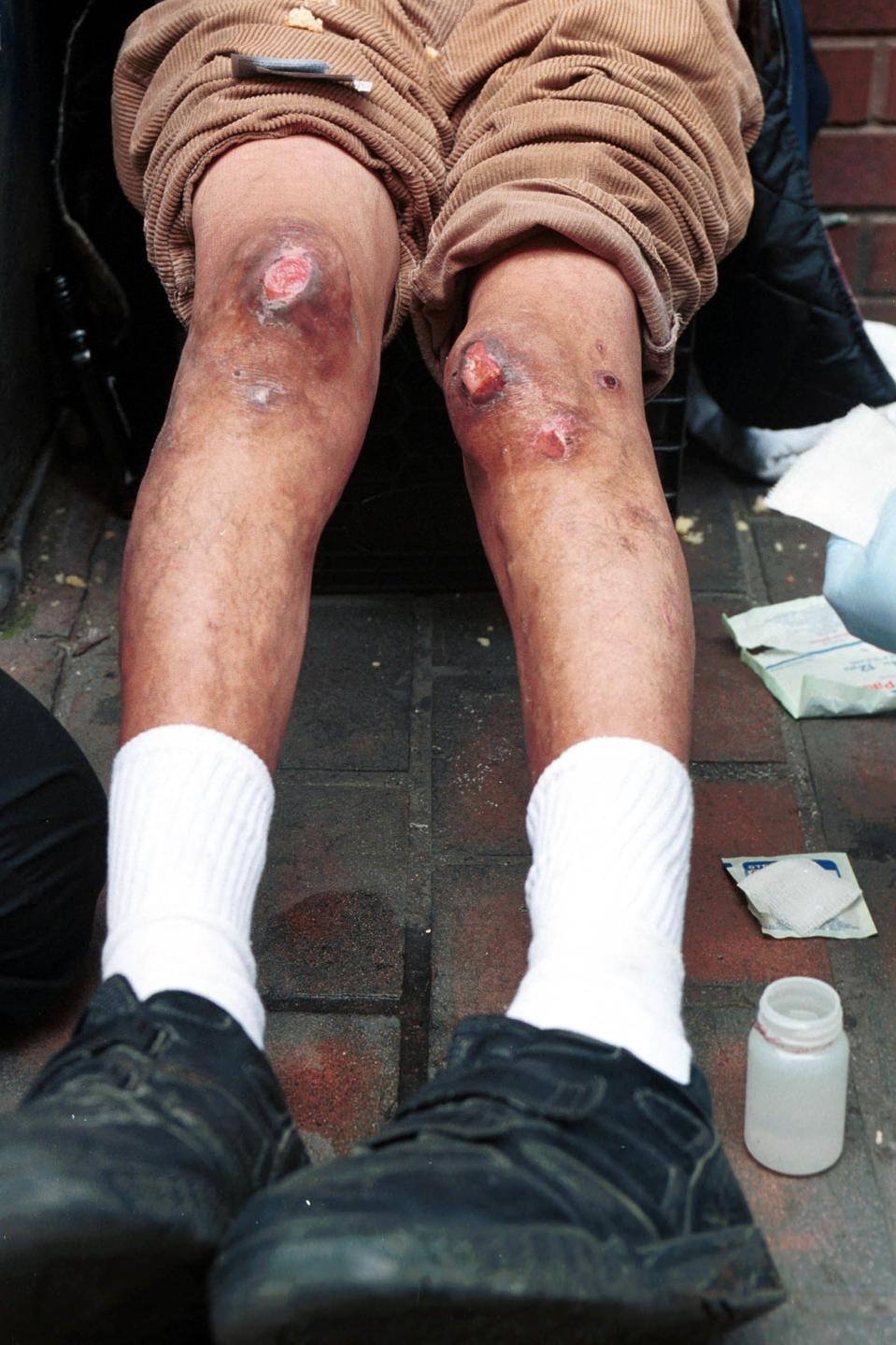 Homeless Health Care in Boston