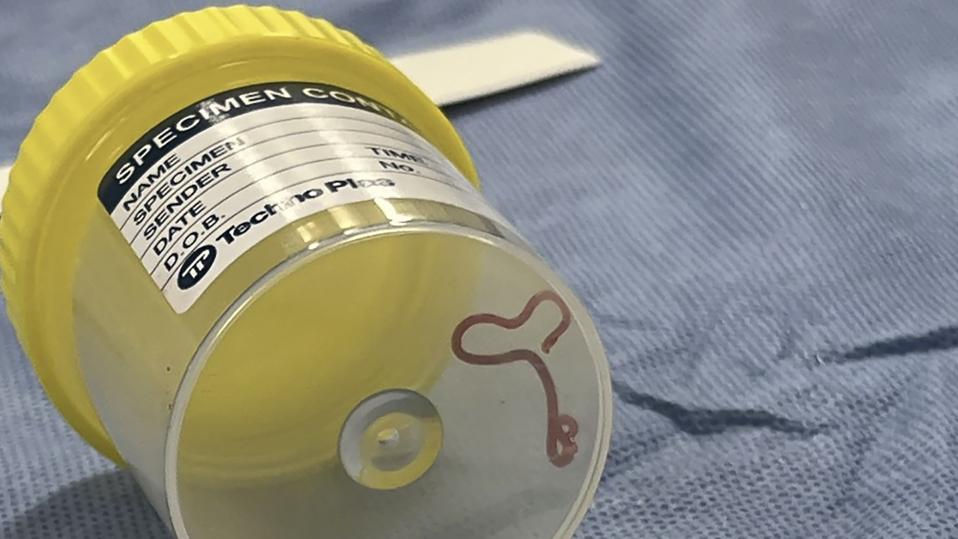 Australia Brain Parasite