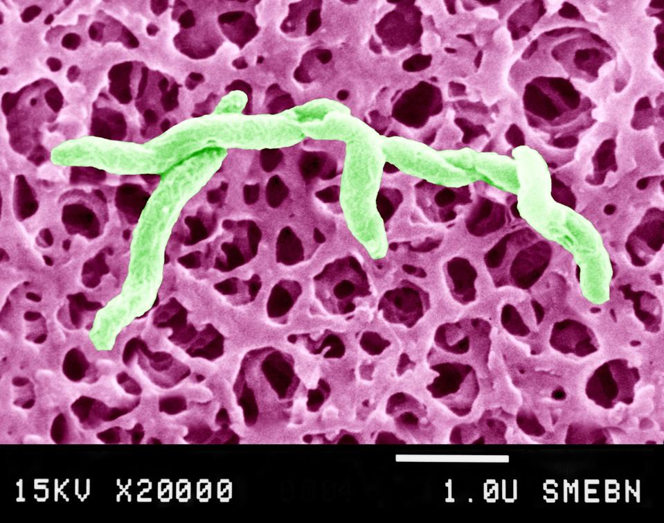 Campylobacter Jejuni