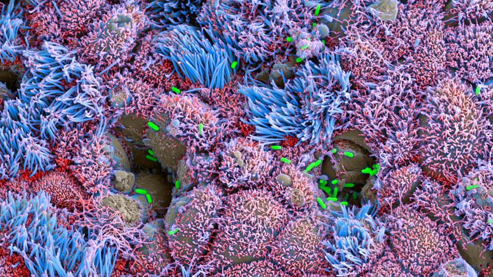 Vivodyne_Airway_Infection_Colored