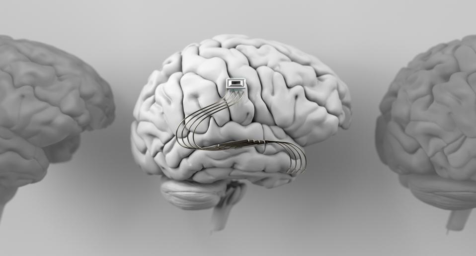 Neurotechnology, implantable brain machine, chip inserted into brain