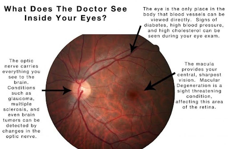 Diagram explaining what retinal images tell physicians