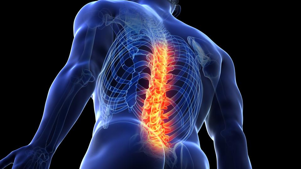 General Back Revolutionizing Chronic Back Pain