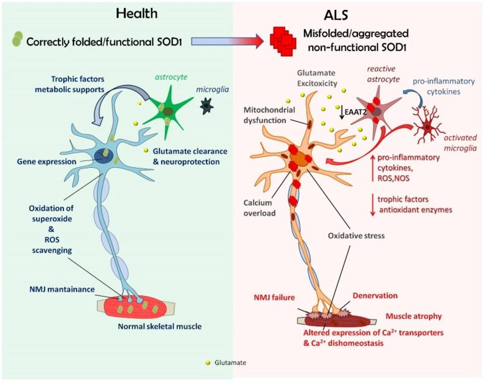 semaglutide and als Slowing ALS Progression Through Gene Therapy