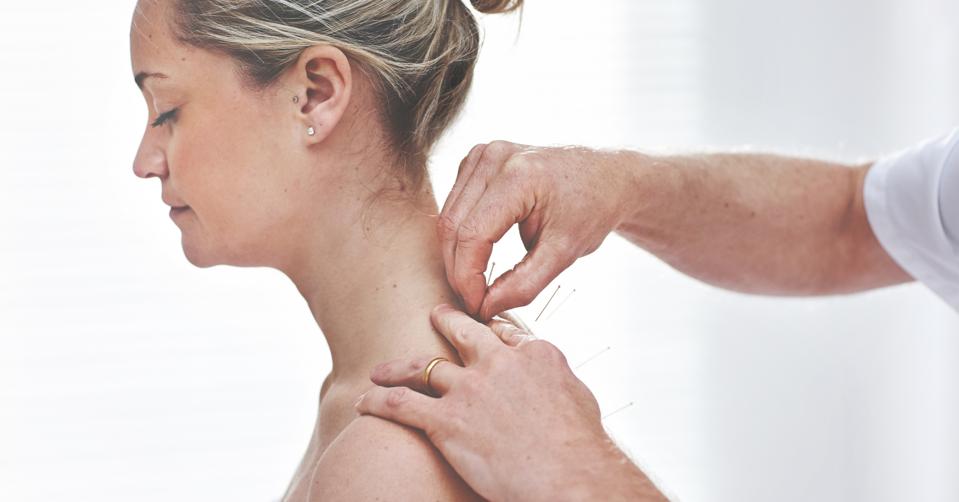 A young woman getting needles inserted into her back during an acupuncture session. A patient getting alternative therapy for medical treatment