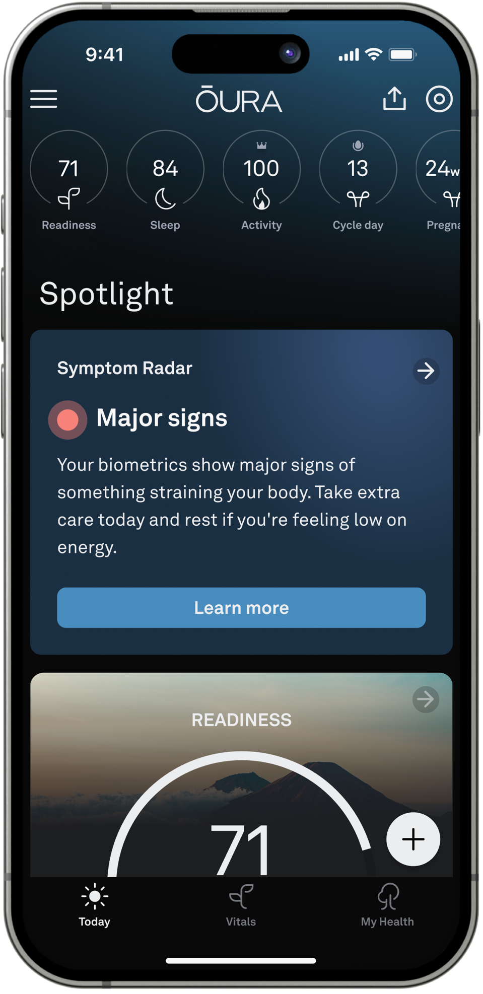 Oura Ring's Must-Have Experimental Feature Has Just Gone Mainstream