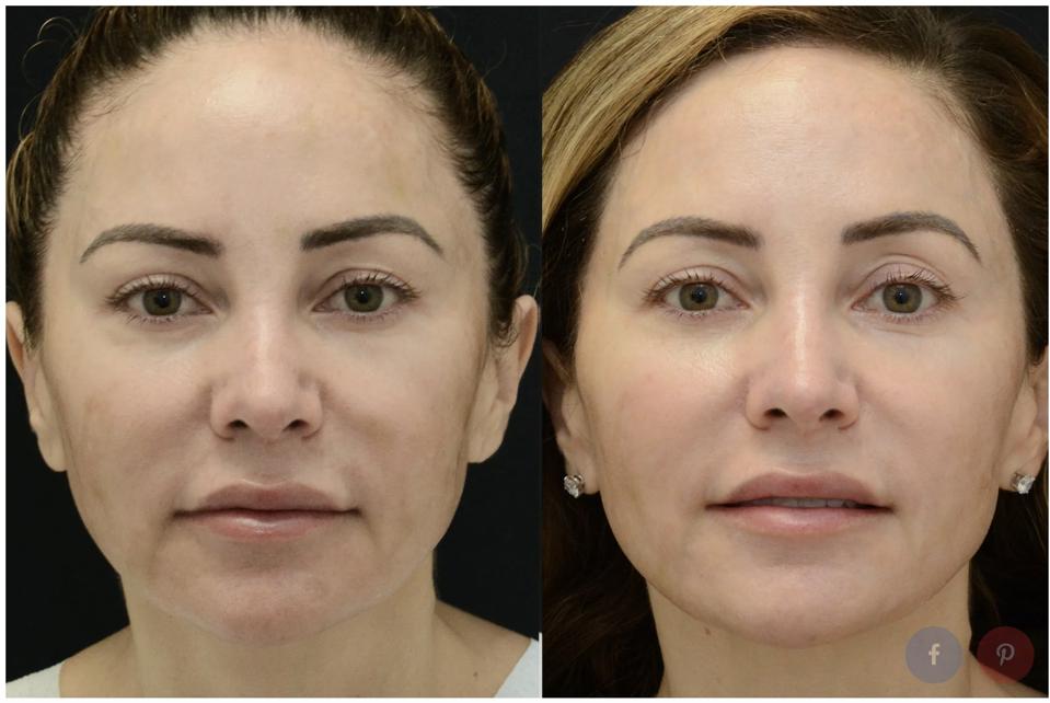 Plastic Surgeons Predict The Top Aesthetic Procedures For 2025