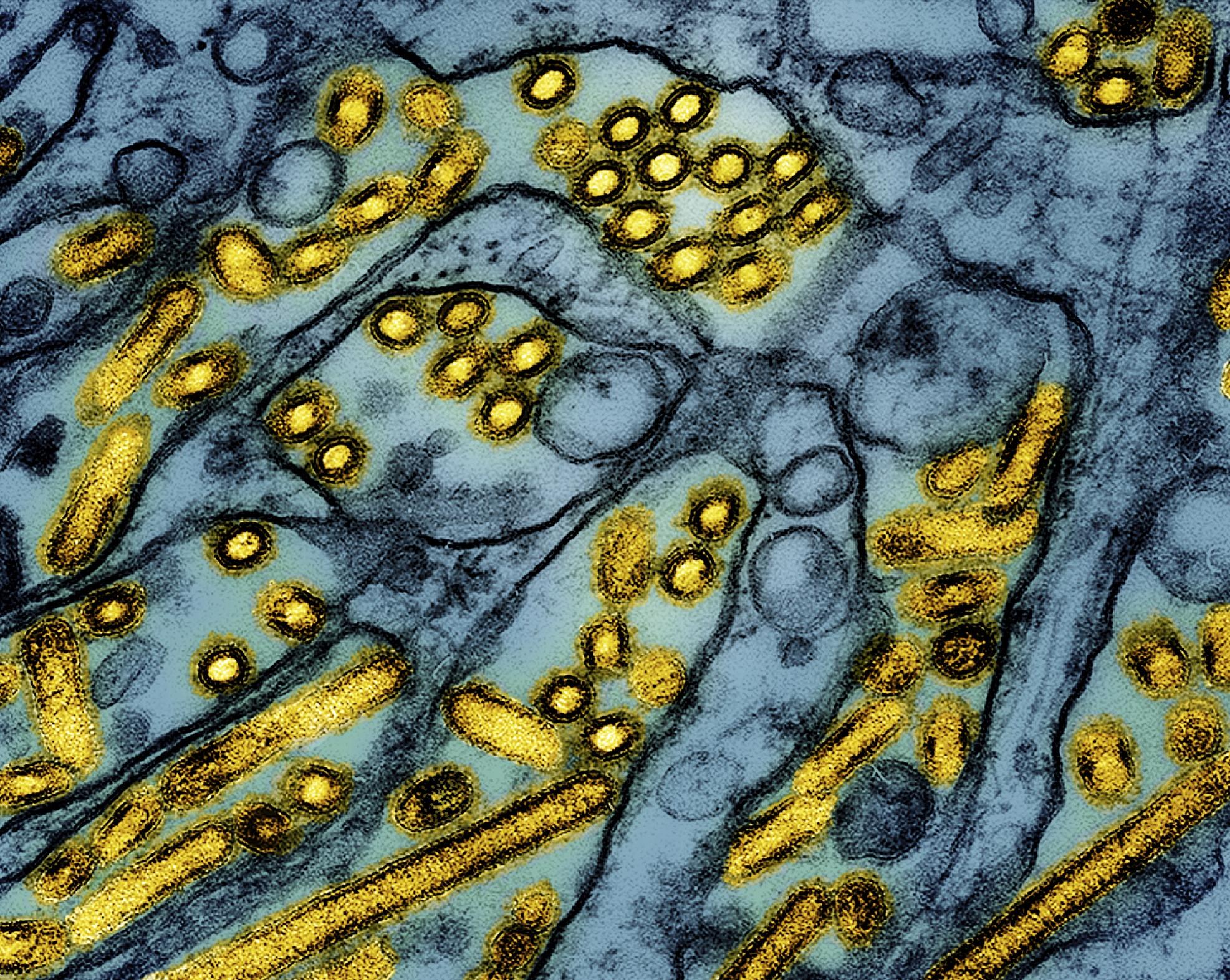 A colorized microscope image of the avian influenza.