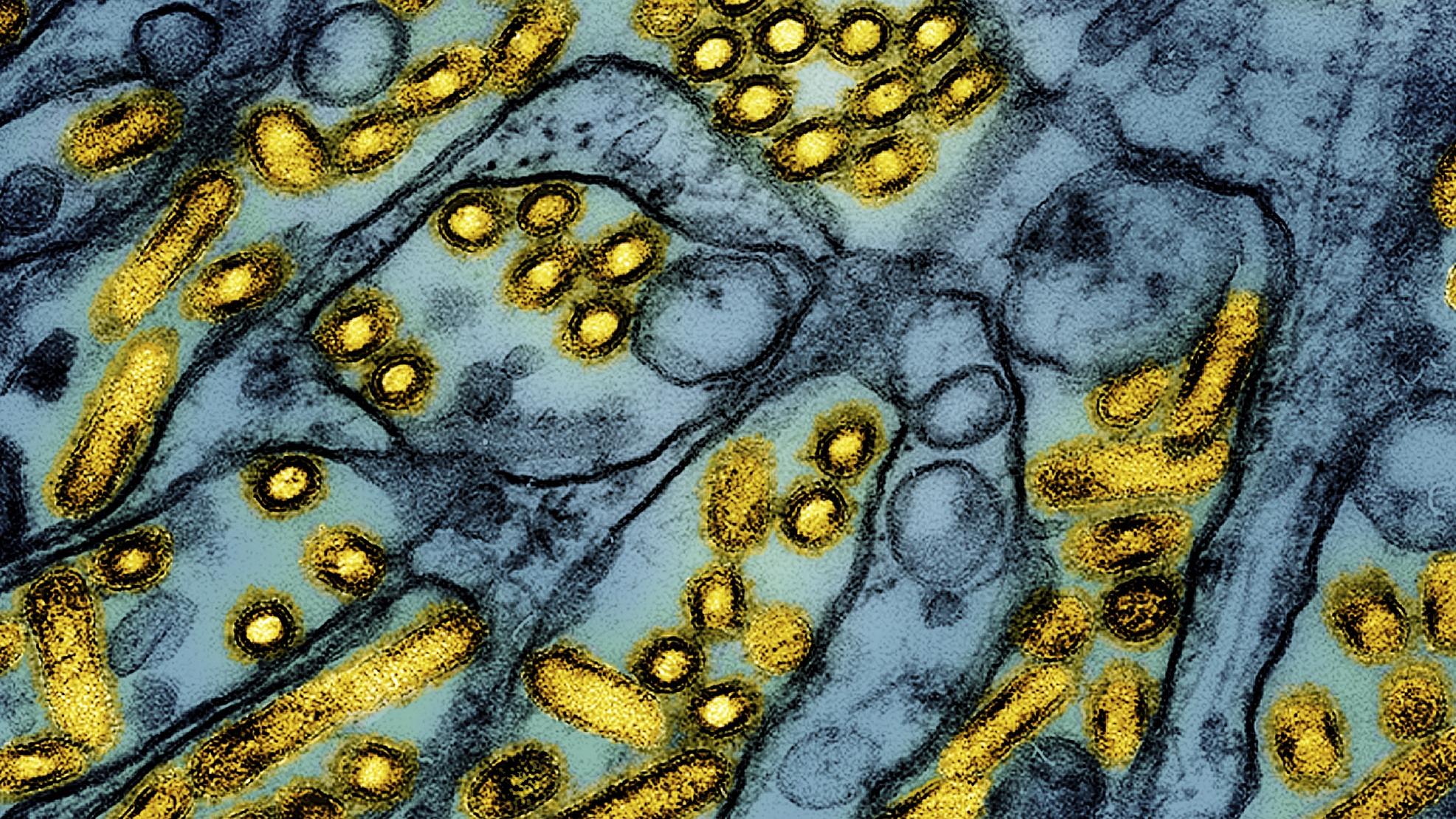 A colorized microscope image of the avian influenza.