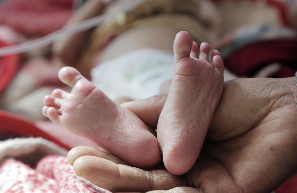 World's Highest Rate Of Malnutrition Is In Yemen 2024