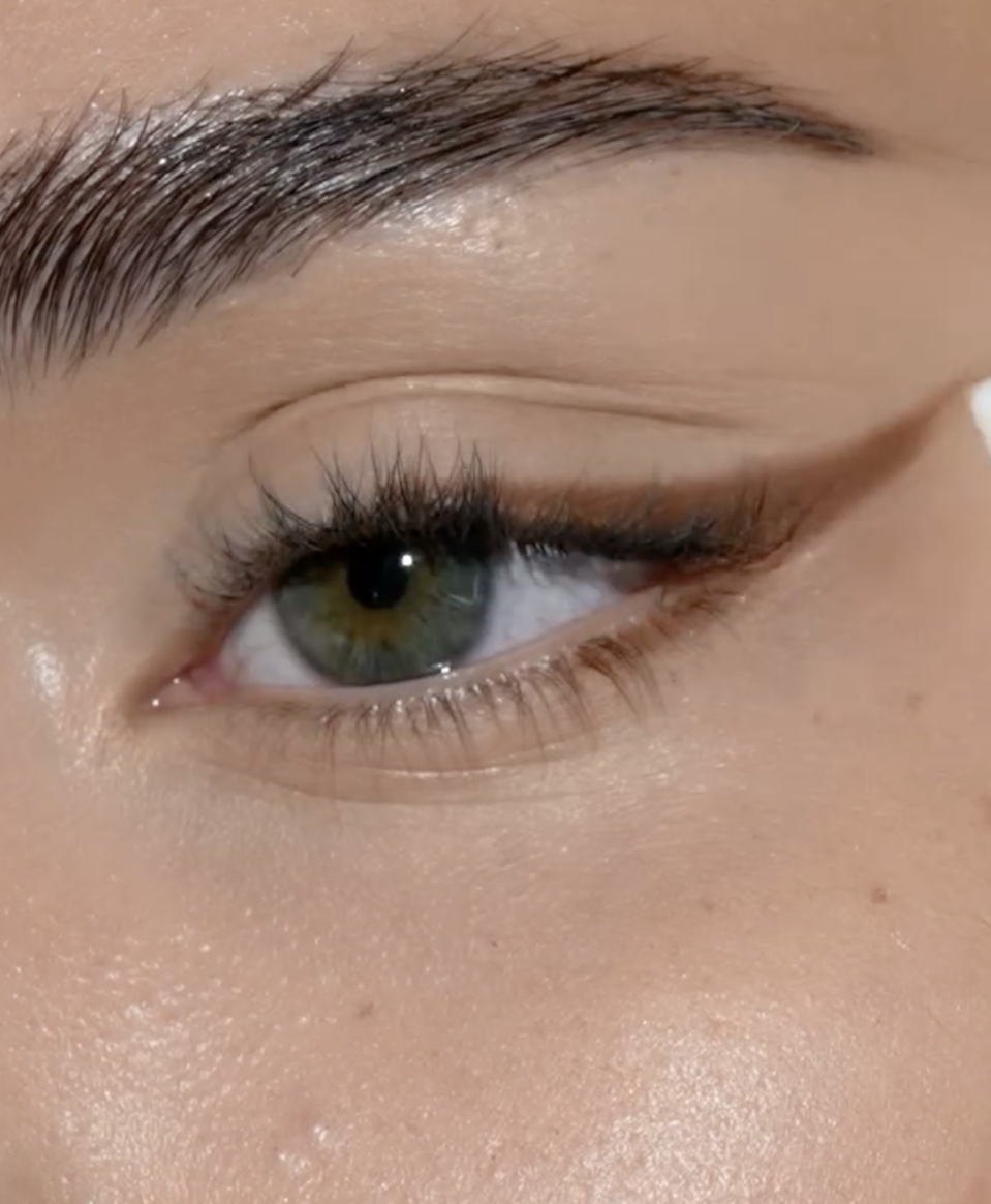 Triple Eyelid On One Eye