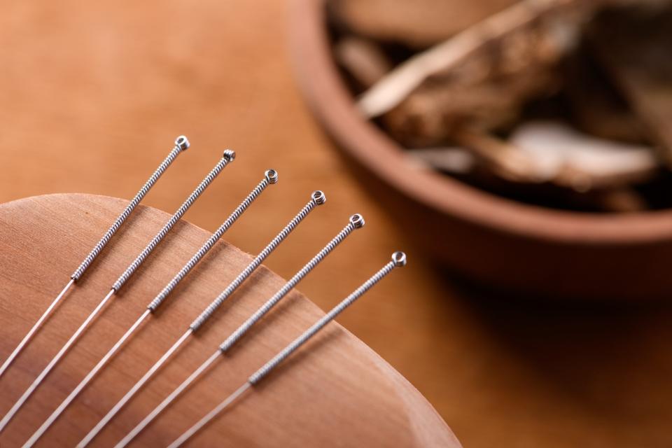 Acupuncture  needles