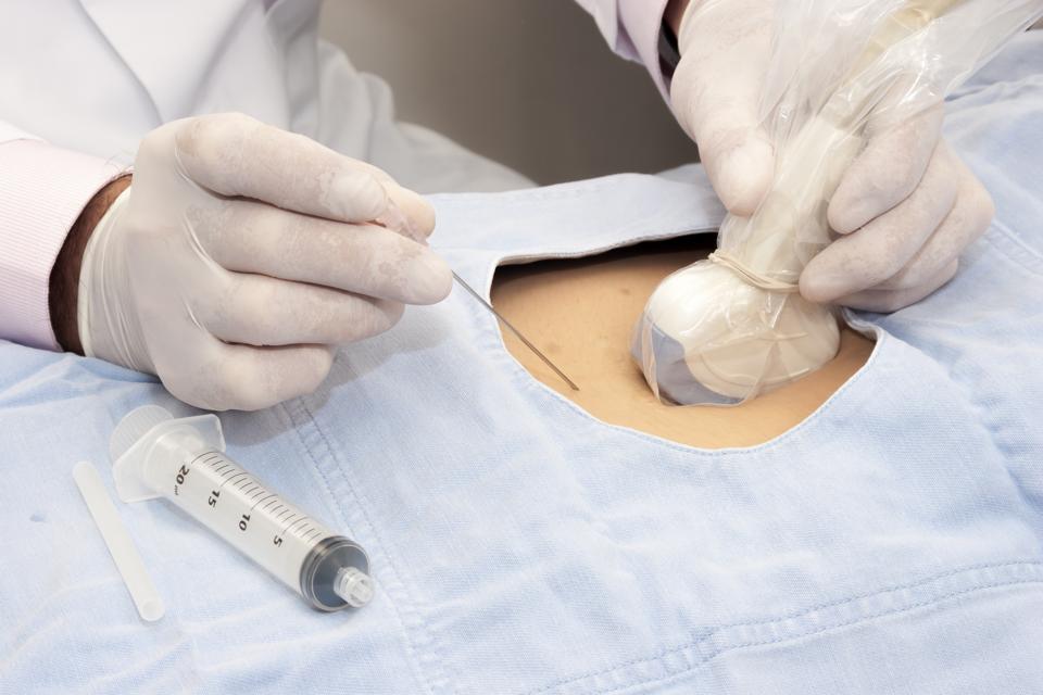 Image-guided needle procedures are one of the most foundational aspects of modern healthcare delivery.