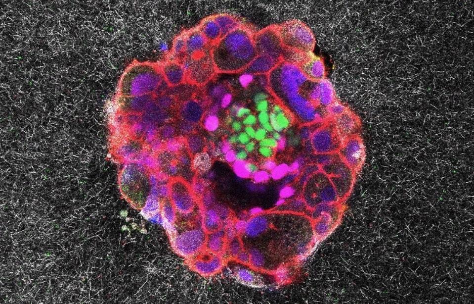 Colorful microscopic image of a ball of embryonic cells meeting a lab-grown uterus