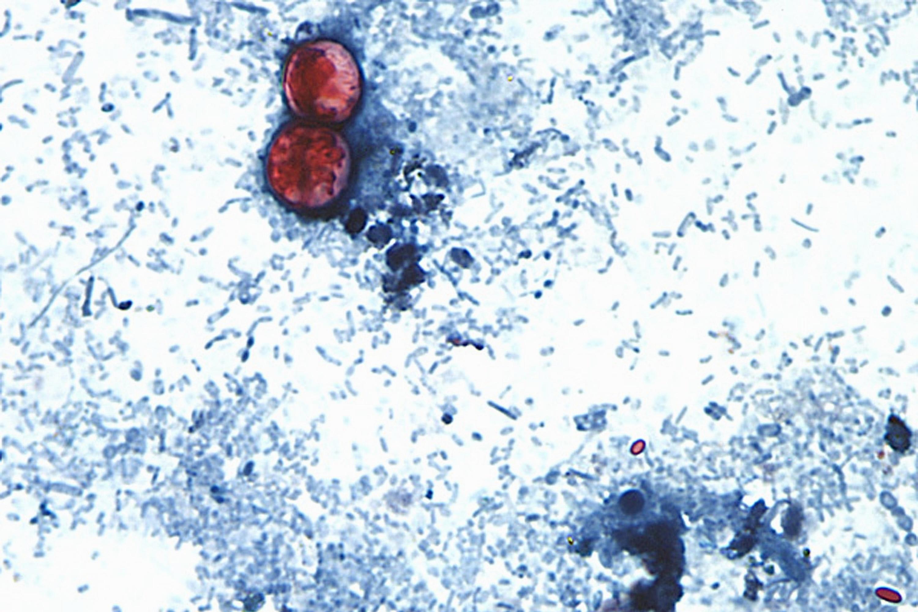 Cyclospora Cases Are Rising, But These Stomach Bugs Are Far More Common
