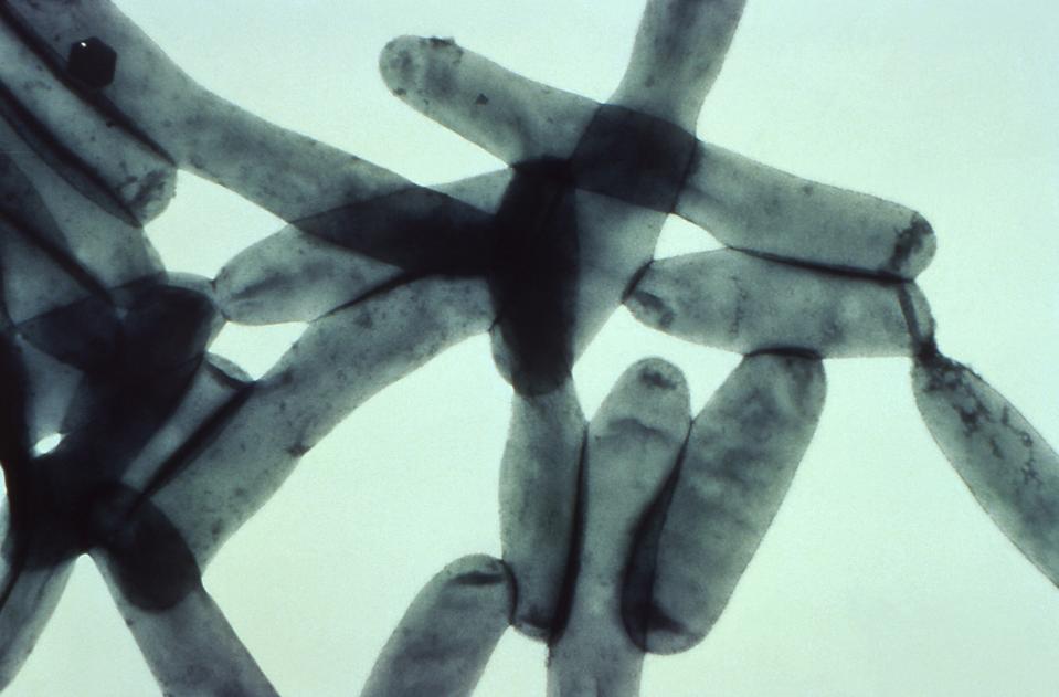 Legionnaires’ Disease Explained—What To Know As A Second NYC Outbreak Emerges