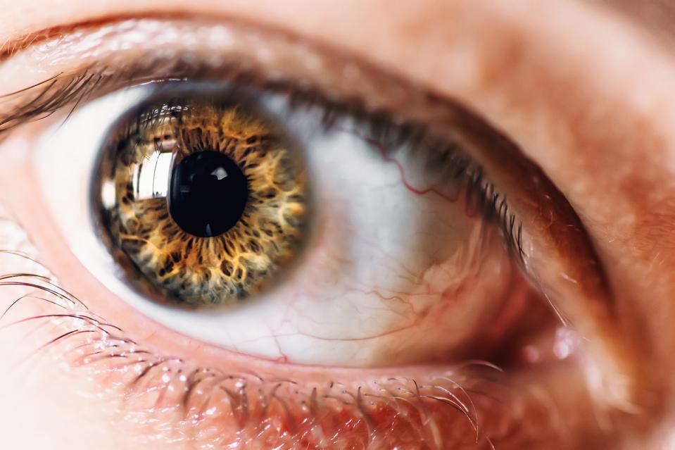 People Whose Eyes Have A Dark Ring Around The Iris Appear More